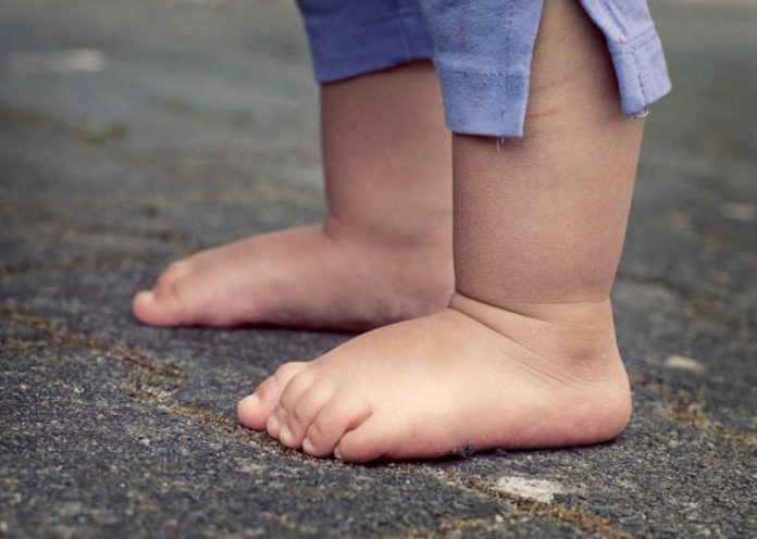 Camminare a piedi nudi? Ecco perché per i bambini è fondamentale